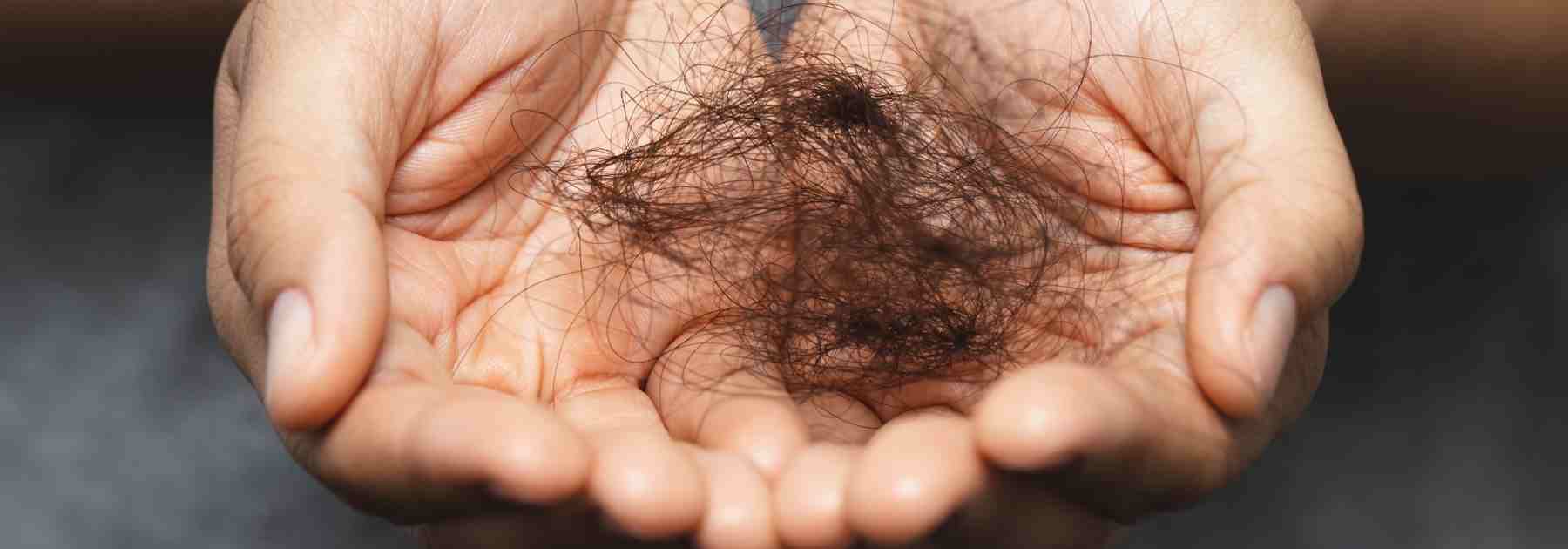 Hair loss treatments for balding men
