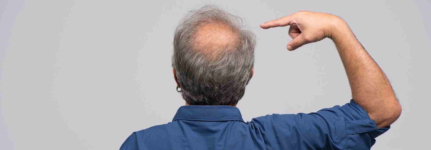 Compare shampoo for hair loss