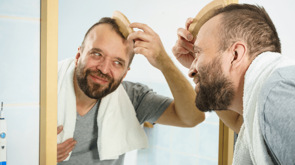 man hair loss