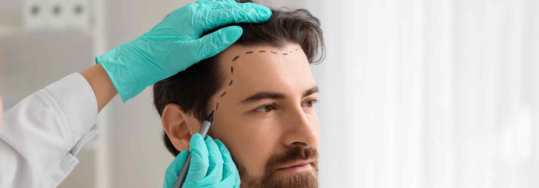 minoxidil foam solution uk