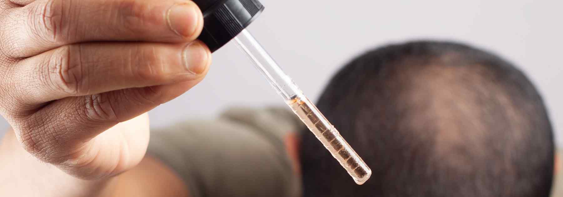 minoxidil uk hair loss treatment